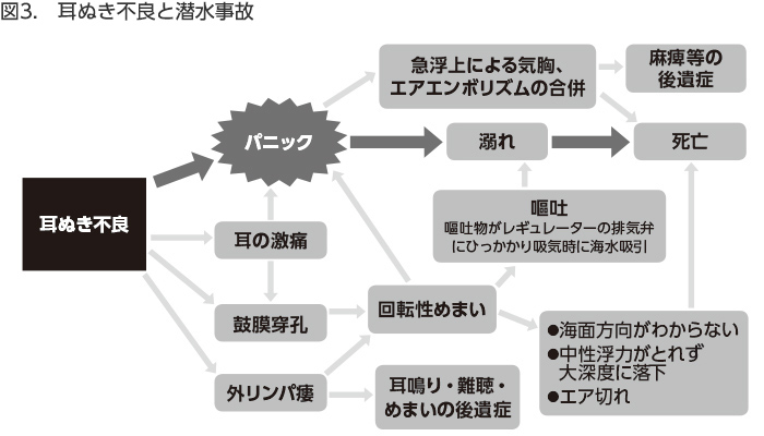 抜き は 耳 と